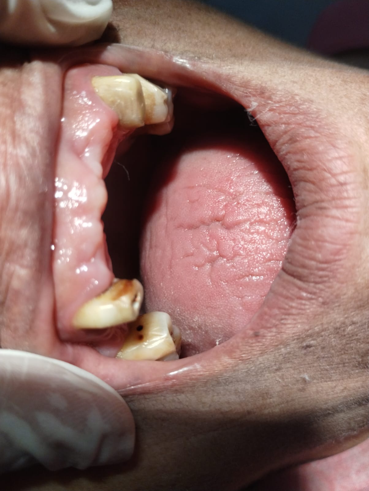 Dental treatment at Odonto Dental Care