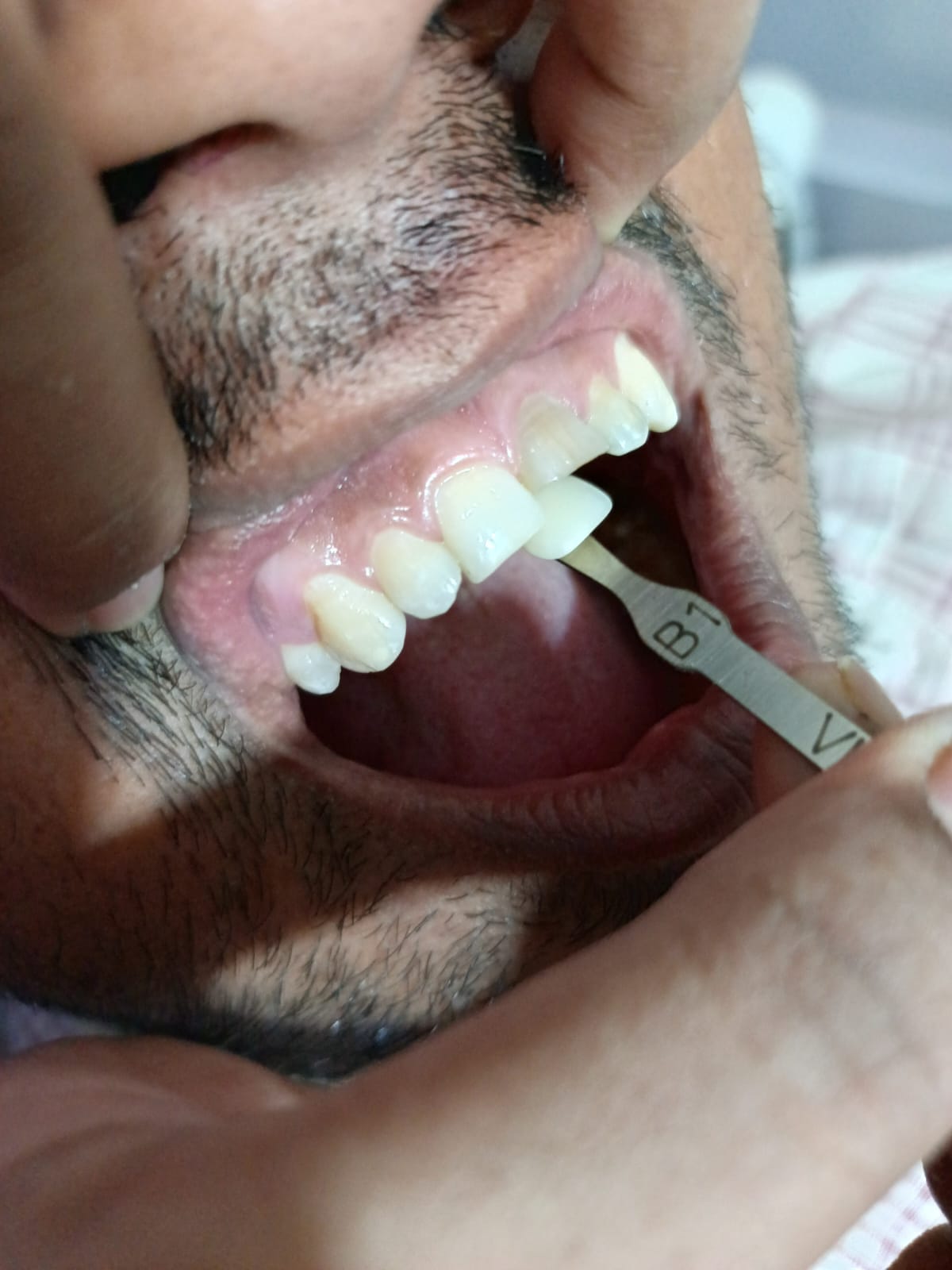 Dental treatment at Odonto Dental Care